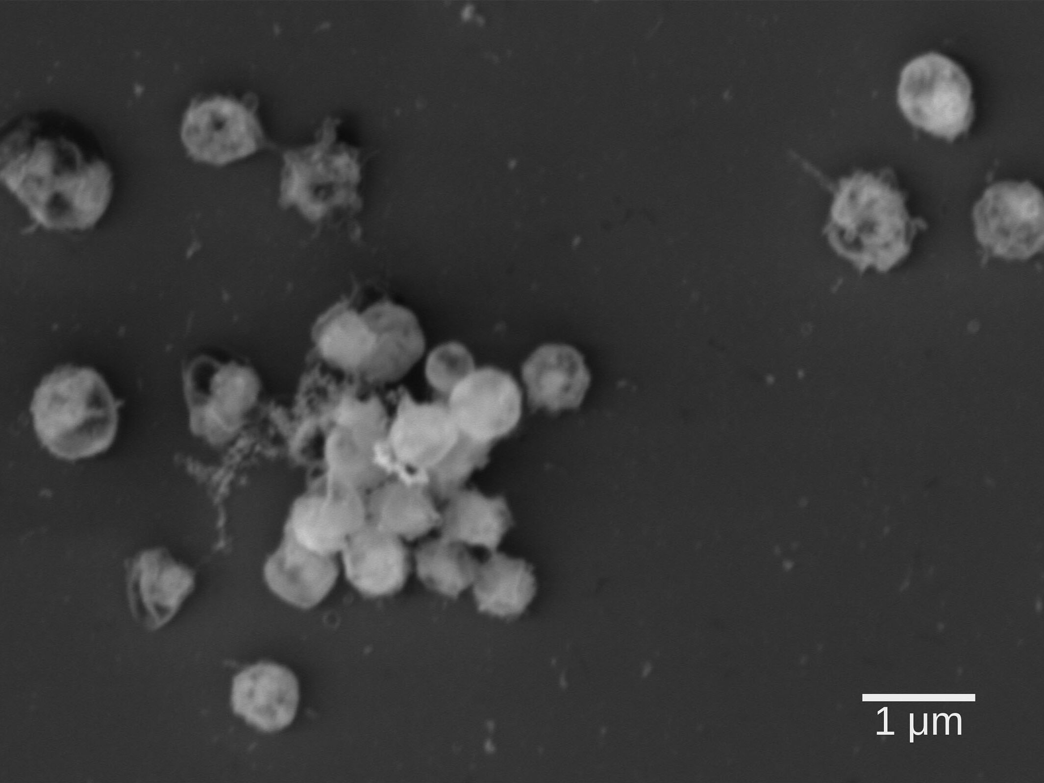 Elektronen-mikroskopische Aufnahme von Lentimonas, einem neu isolierten Bakterium, das Fucoidan abbauen kann an. Man sieht, dass die Zellen kleine runde Kokken sind und als Aggregat wachsen. – Foto: Max-Planck-Institut für Marine Mikrobiologie, A. Sichert