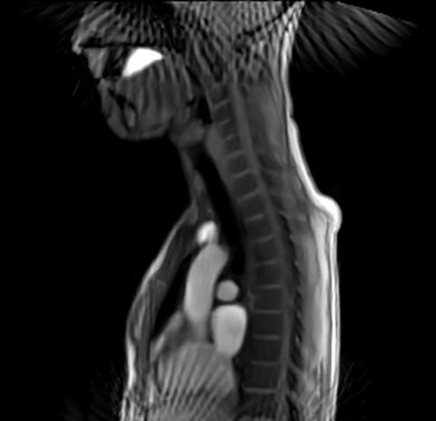 Visualization of the process of swallowing and esophageal transit.